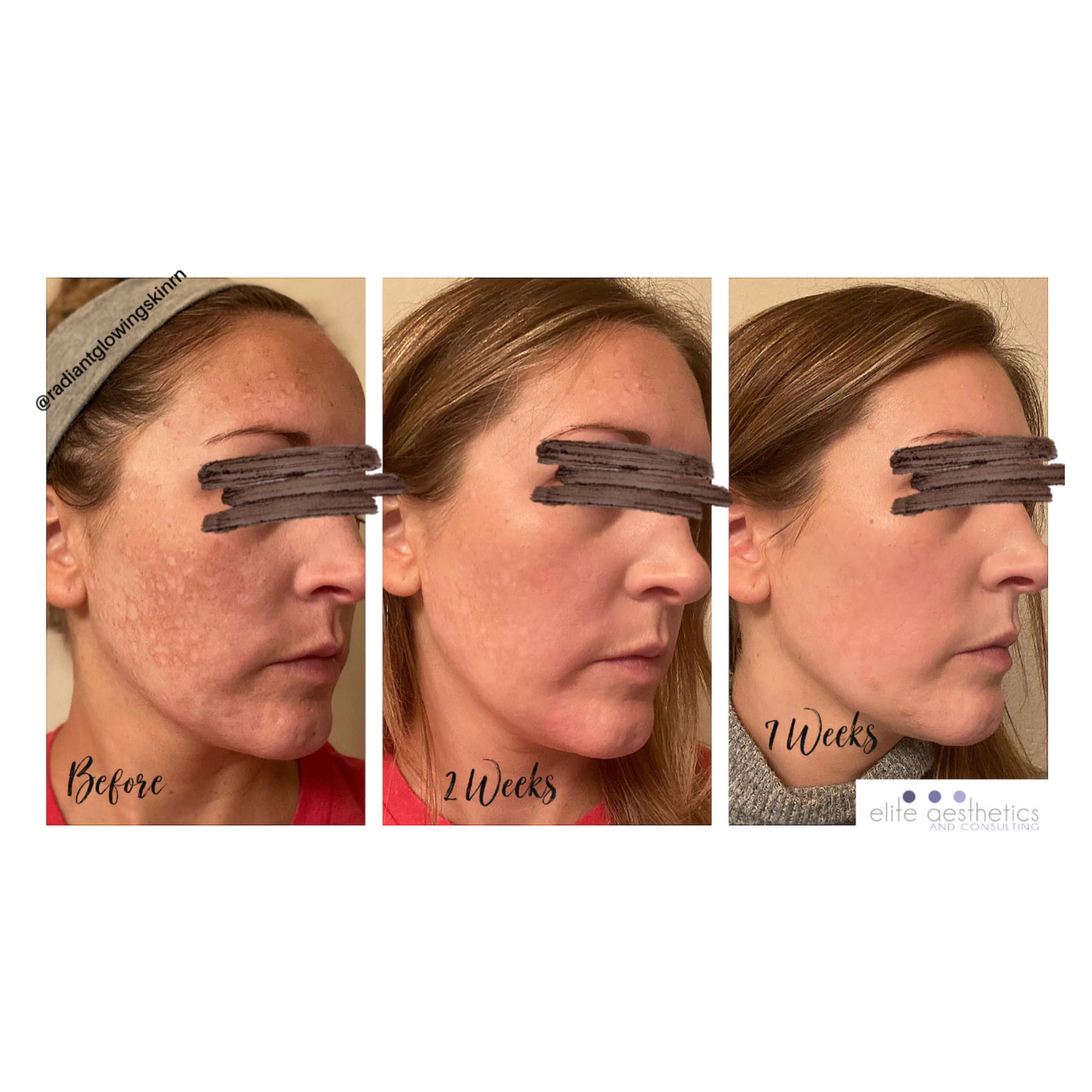 How do celebrities get their skin so shiny?