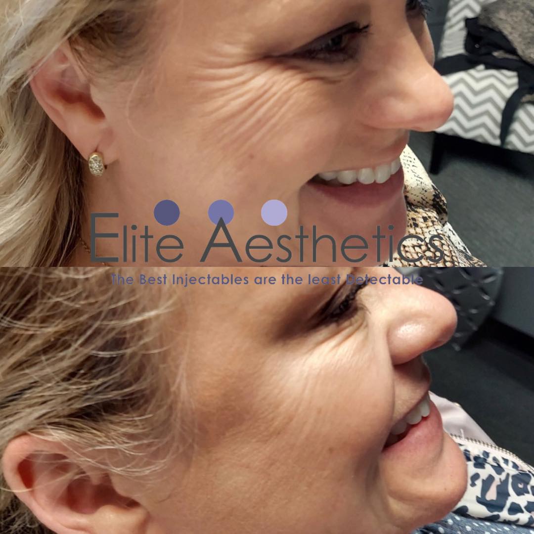 Facial Overland Park Kansas