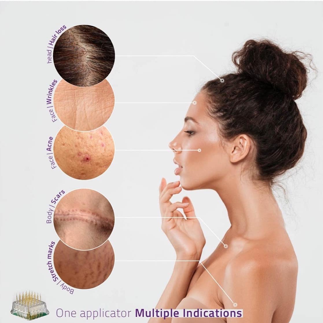 Fat reduction Overland Park Kansas