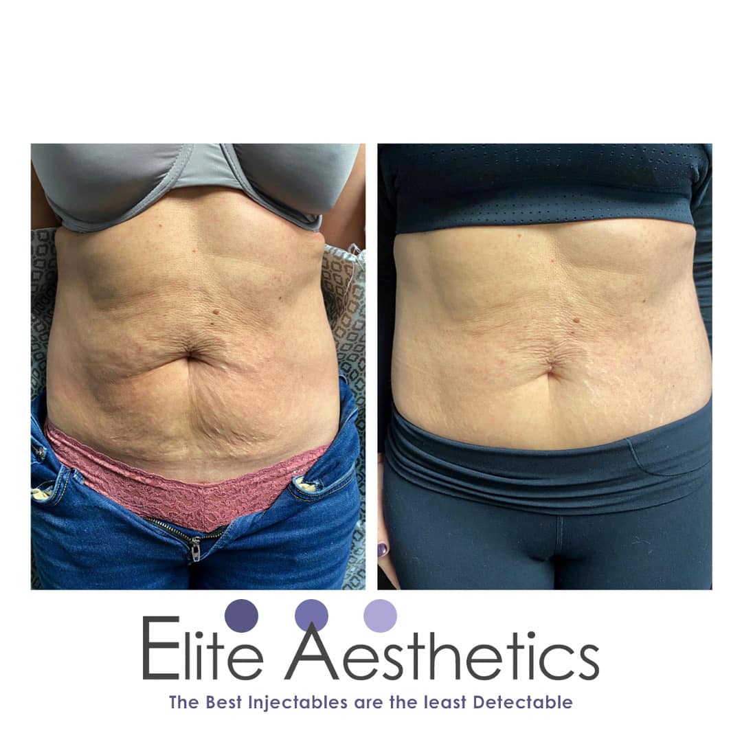 What can I name my spa business?