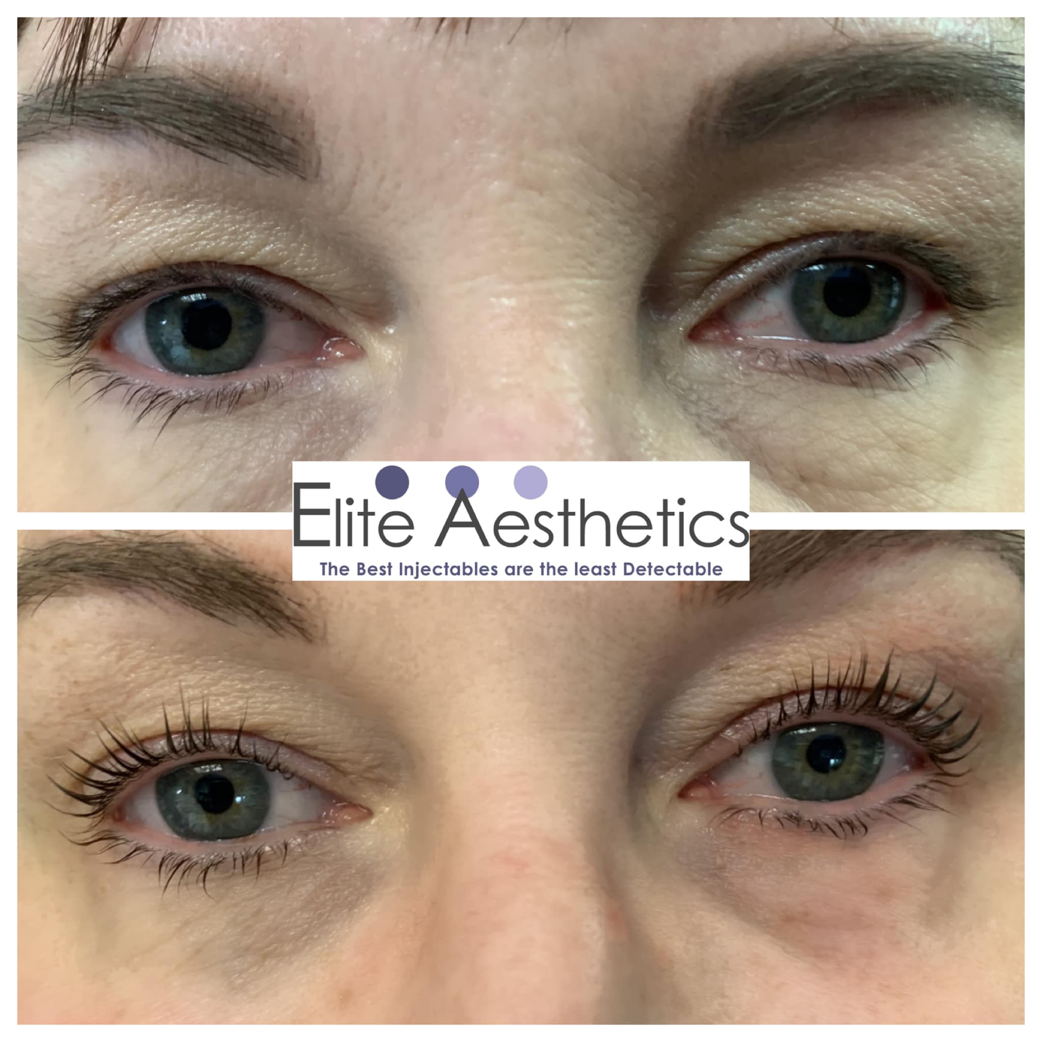 Lips Overland Park Kansas