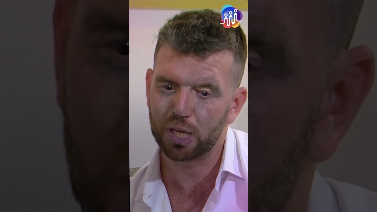 He woke up blind… and the first thing he asked was...