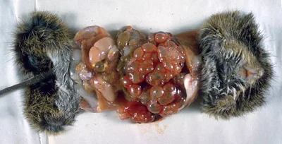 Echinococcus